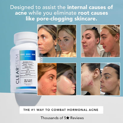 - MINDBODYSKIN Hormonal Acne Supplement (5-HTP) - Natural DIM Supplement - Skin Care Vitamins - Hormone Balance, Antioxidants - Vegan, Gluten Free, Cruelty Free - 30 Servings, 90 Capsules